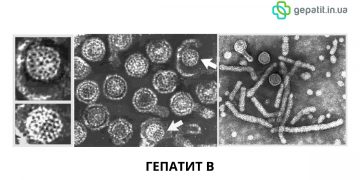 Что такое гепатит В (Б)